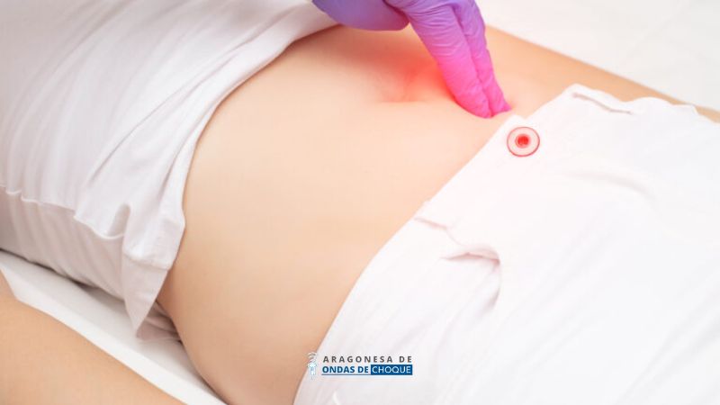 ondas de choque para dolor pélvico crónico en Zaragoza