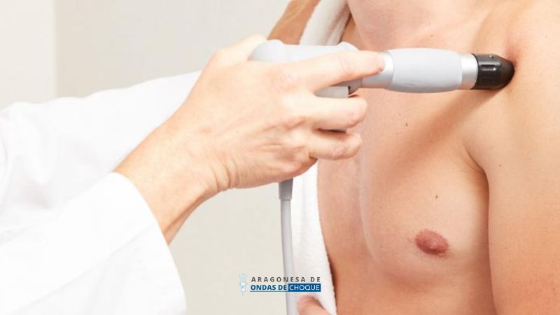 tratamiento de ondas de choque para calcificación de hombro en zaragoza dolor precio