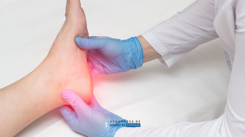 tratamiento para espolón calcáneo en zaragoza
