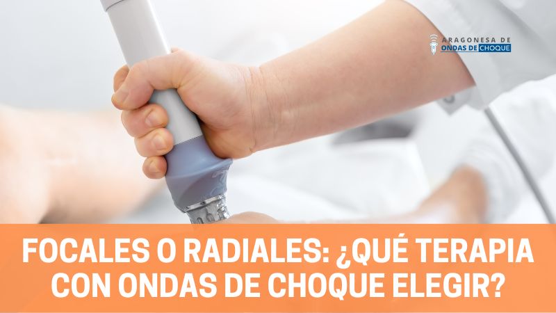 Focales o radiales: ¿qué terapia con ondas de choque elegir?