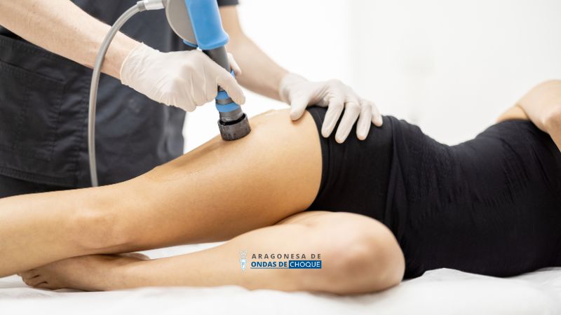 Ondas de choque para tratar la celulitis