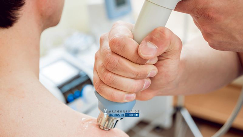 Cuánto tarda en curarse la tendinitis calcificada