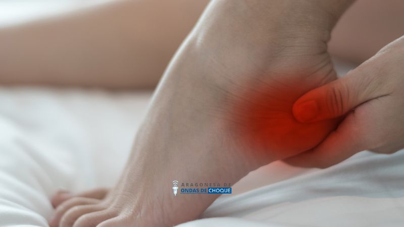 ¿Es bueno andar con un espolón calcáneo?